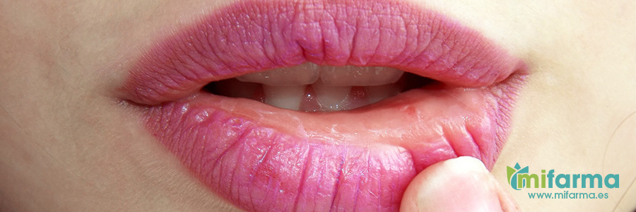 Las aftas bucales es una enfermedad de la boca