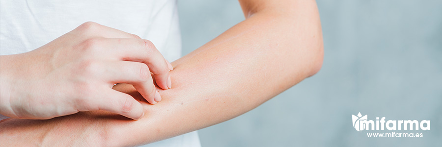 Dermatitis causas y sintomas de esta enfermedad en la piel
