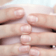 manchas blancas en las uñas cómo eliminar
